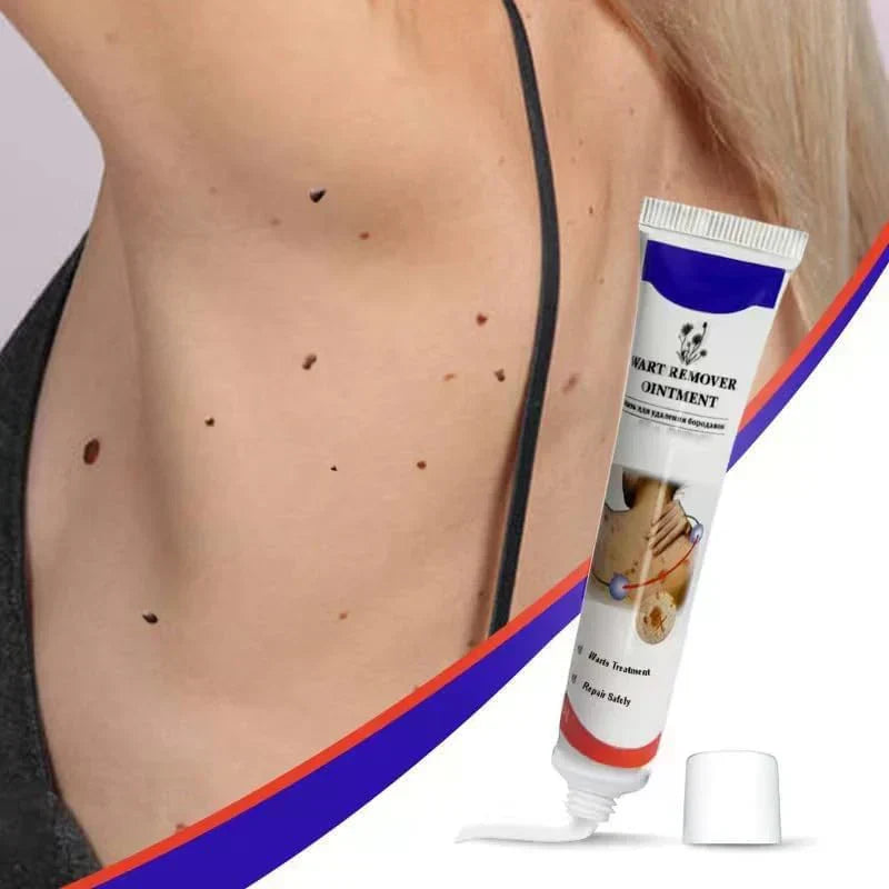 Warts Remover